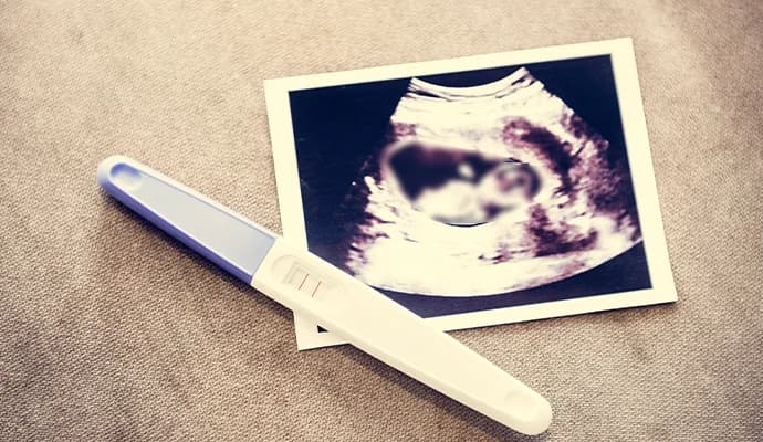 Kürtaj Paralı Mı?